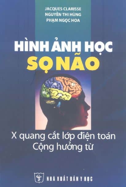 Hình ảnh học sọ não